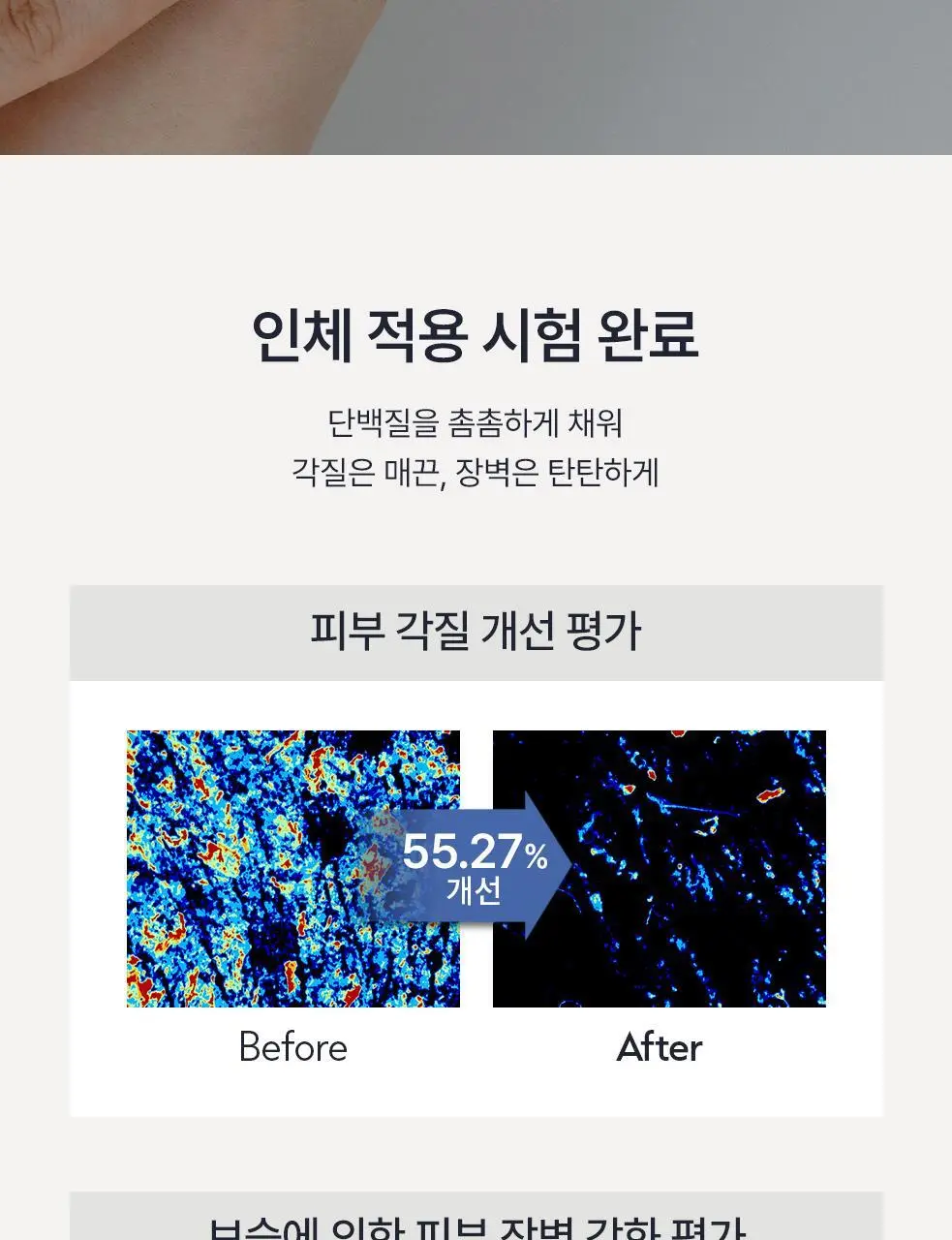 [단독구성/보습세트] 오브제 모이스처 프로틴 토너/크림 2종 기획 상세페이지 39